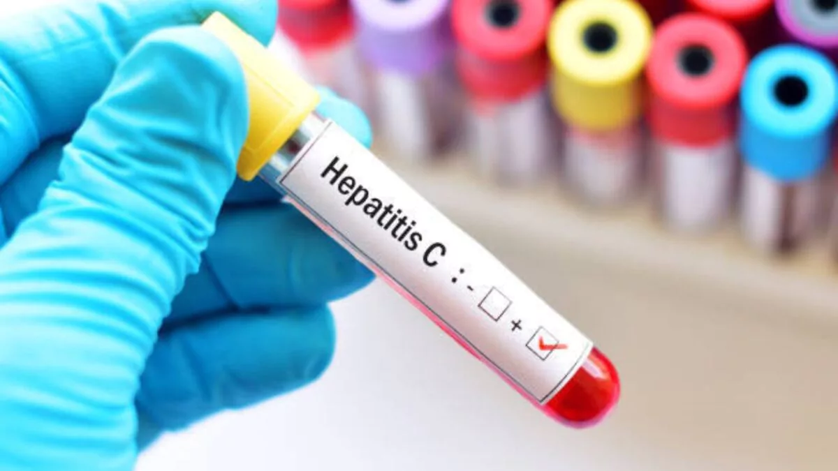OMS alerta sobre aumento de muertes por hepatitis y pide acelerar la detección y el tratamiento