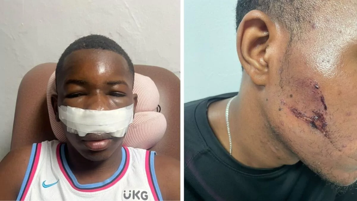 Dos jóvenes resultan heridos tras choque de vehículo contra buggy en Punta Cana